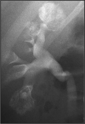 Stacks Image 1005