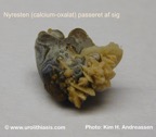 117c-kidney-stone_nyresten-calciumoxalate-spontan-Kim-Hovgaard-Andreassen