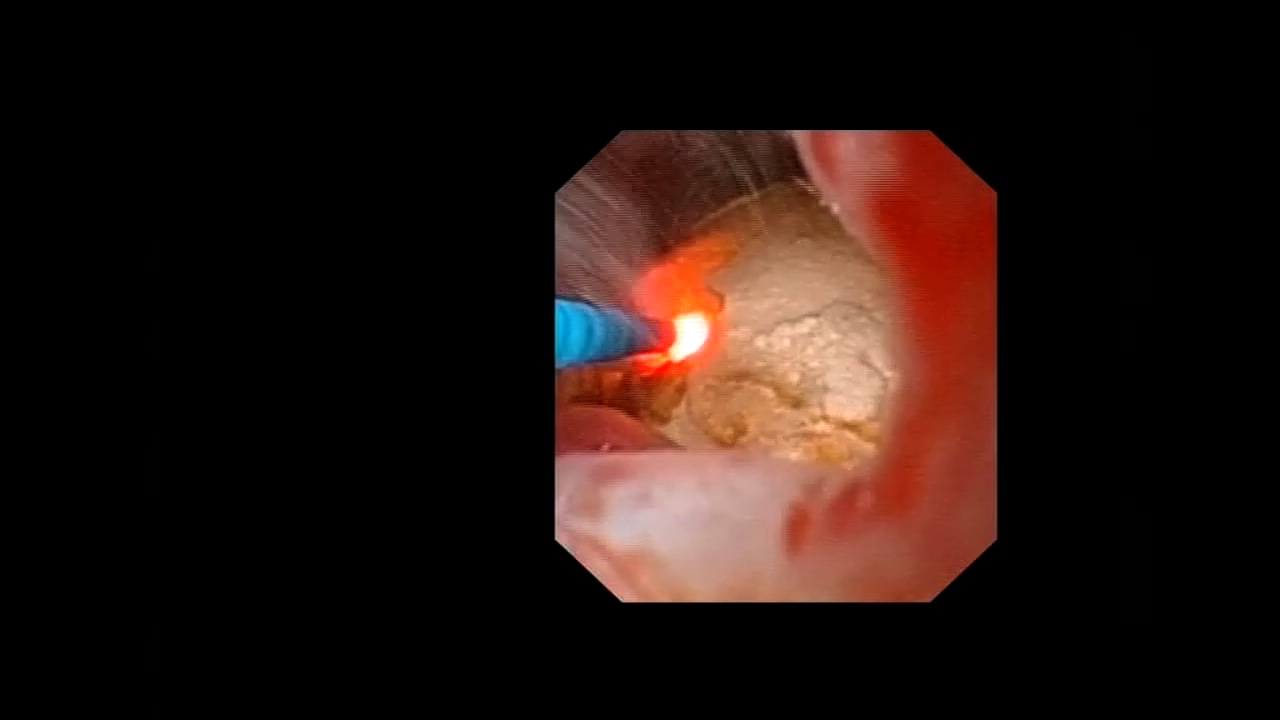 RIRS_VIDEO003-UT.mp4